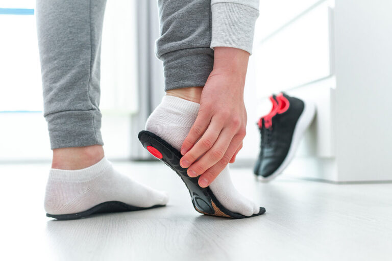 Foot arch supports