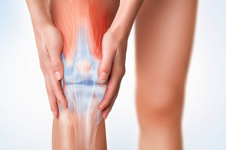Knee injury