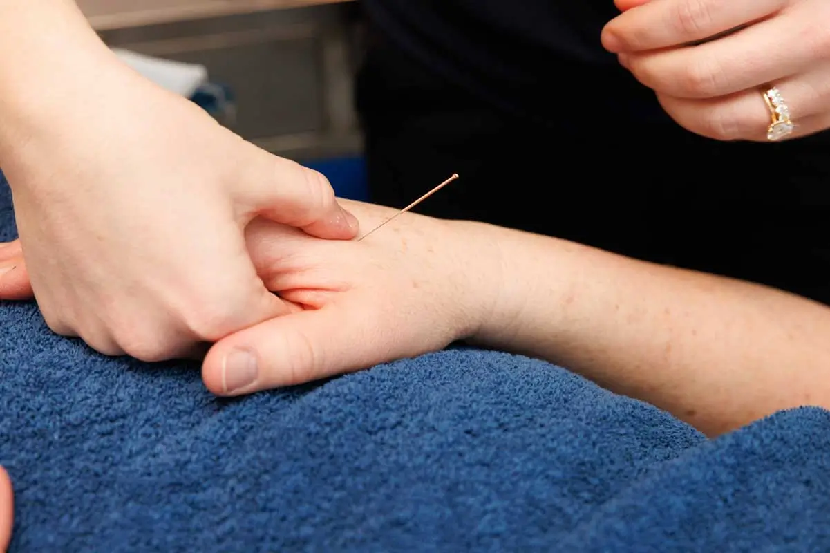Richmond Photos Acupuncture 1