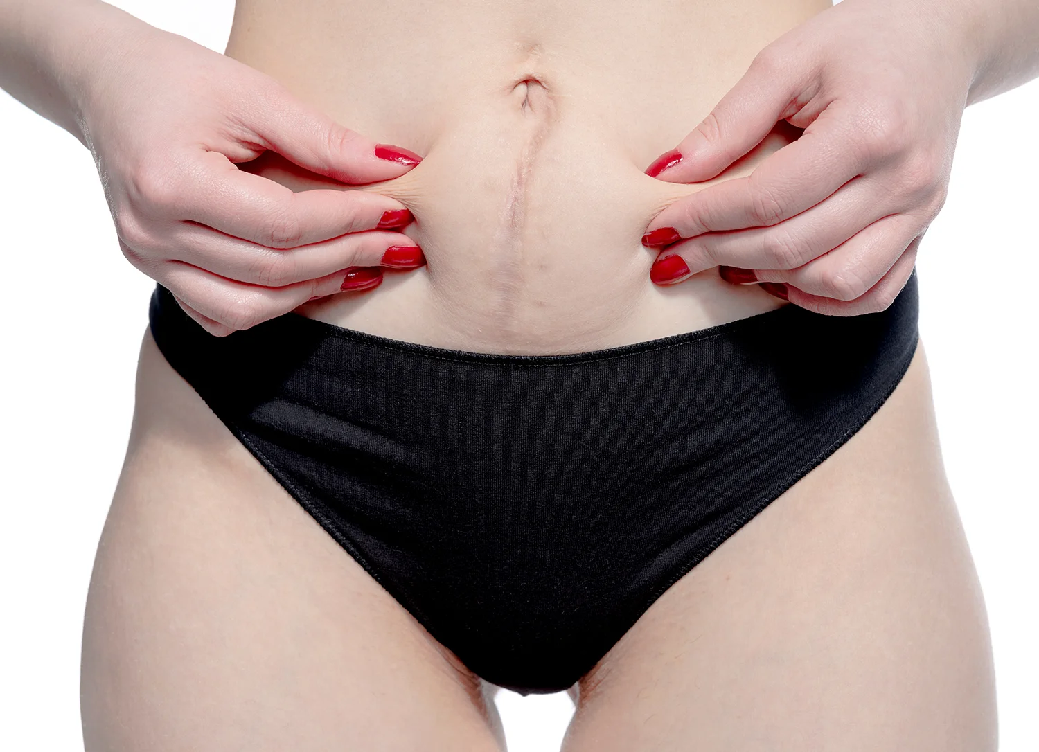 woman holding abdominal skin after surgery close